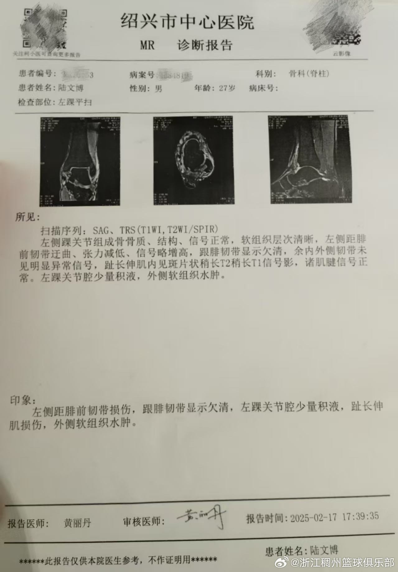 结果对赛事